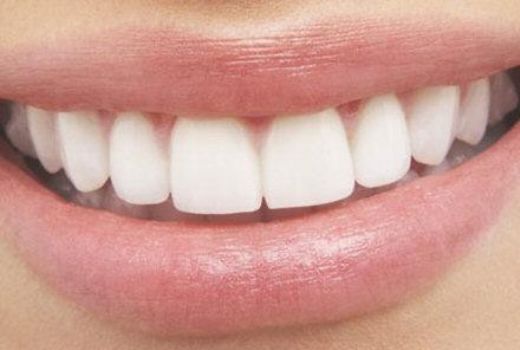 Diş Dolgusu Sonrası Yapılması Gerekenler 