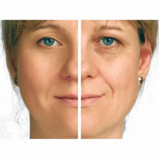 Juvederm Dolgu İçeriği